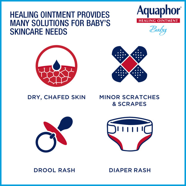 Kem Chống Hăm Và Làm Dịu Da Dành Cho Bé Aquaphor Baby Advanced Therapy Healing Ointment – Hũ 14 oz