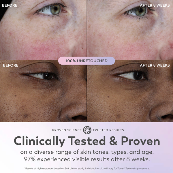 Tinh Chất Dưỡng Da Olay Super Serum – Chai 1 Oz